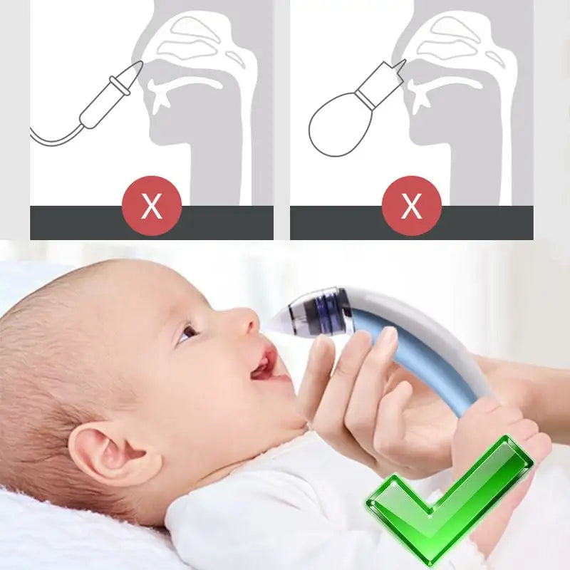 Baby Electric Nasal Aspirator – Gentle, Safe, and Easy Nose Cleaning!